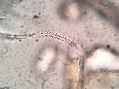 Flagelloscypha minutissima