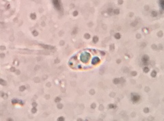 Flagelloscypha minutissima