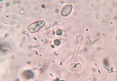 Flagelloscypha minutissima