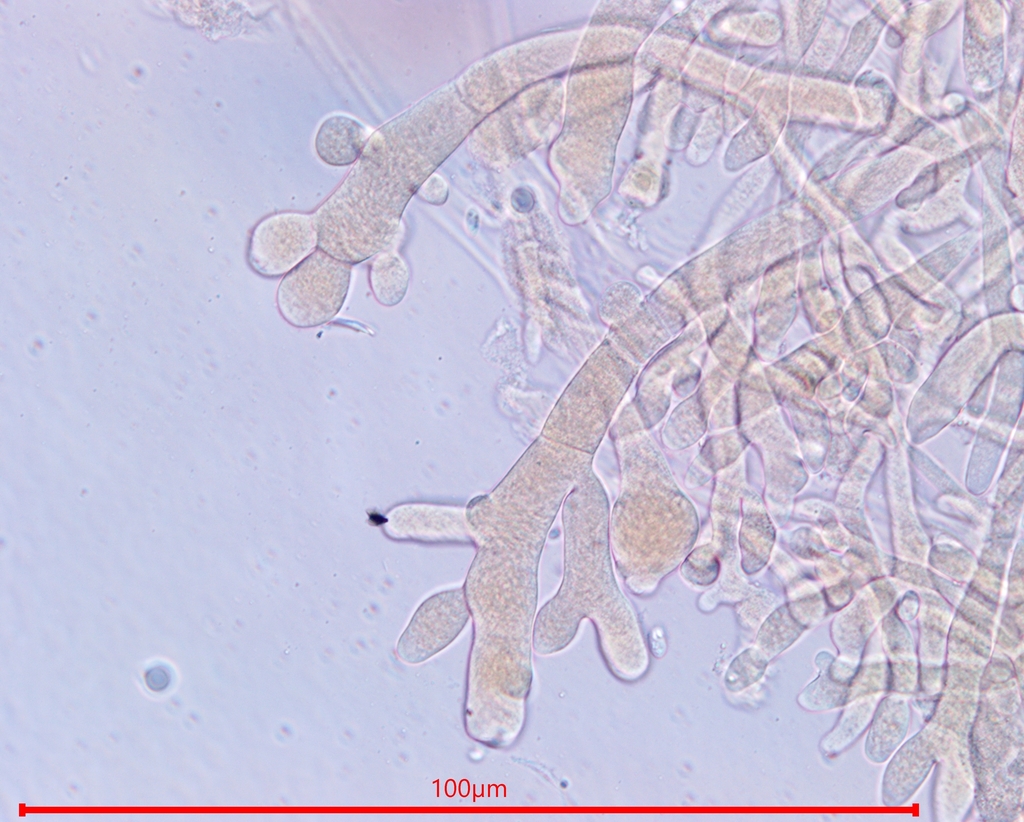 Neurospora