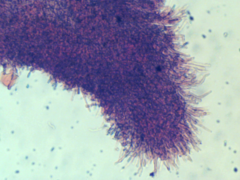 Hyphodontia arguta