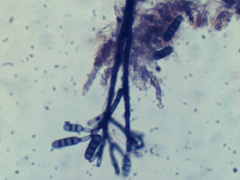 Kirschsteiniothelia atra