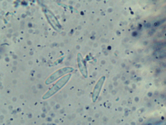 Mitrula lunulatospora