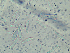 Mitrula lunulatospora