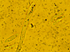 Mitrula lunulatospora