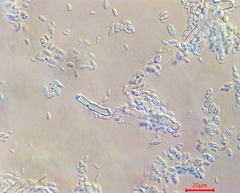 Aureobasidium subglaciale