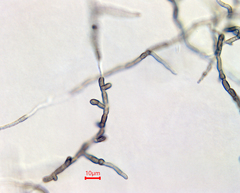 Aureobasidium subglaciale