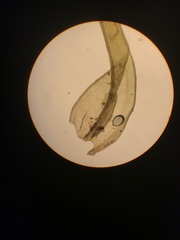Racomitrium pacificum