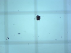 Dolichospermum lemmermannii