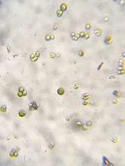 Chlorella vulgaris