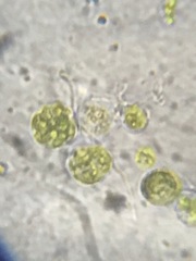 Chlorella vulgaris