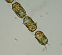 Stephanopyxis nipponica