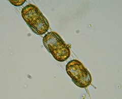 Stephanopyxis nipponica