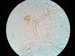 Dialonectria episphaeria