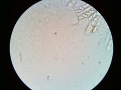 Dialonectria episphaeria