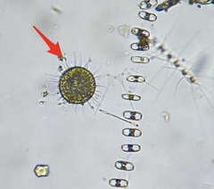 Heliozoa