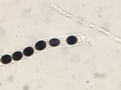 Biscogniauxia marginata