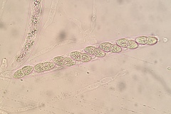 Caudospora taleola