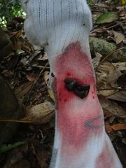 Haemadipsa zeylanica