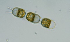 Stephanopyxis nipponica