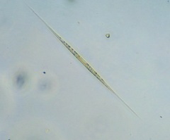 Nitzschia acicularis