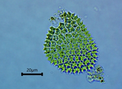 Pseudopediastrum boryanum