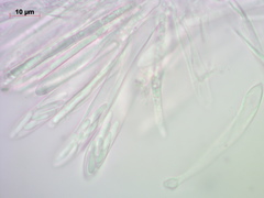 Hyaloscypha secalina