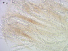 Rutstroemia paludosa