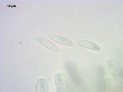 Rutstroemia paludosa