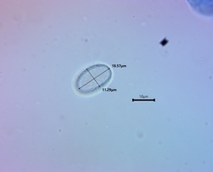 Scutellinia olivascens