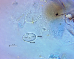 Scutellinia olivascens