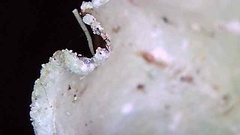 Cetrelia cetrarioides