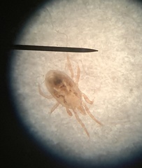 Ornithonyssus sylviarum