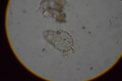 Euglypha strigosa
