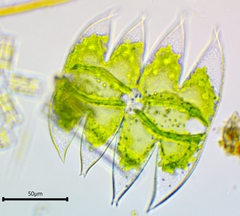 Micrasterias laticeps