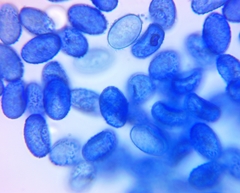 Scutellinia vitreola