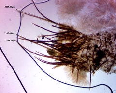 Scutellinia vitreola