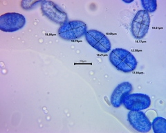 Scutellinia vitreola