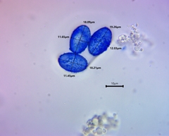 Scutellinia vitreola