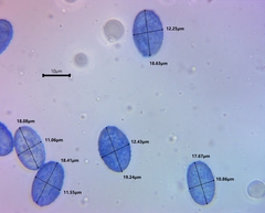 Scutellinia vitreola