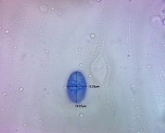 Scutellinia vitreola