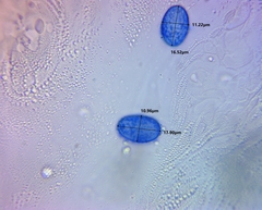 Scutellinia vitreola