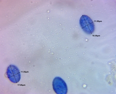 Scutellinia vitreola