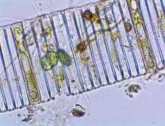 Fragilaria