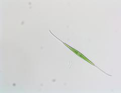 Closterium kuetzingii