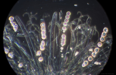 Pulvinula archeri