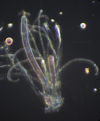 Pulvinula archeri