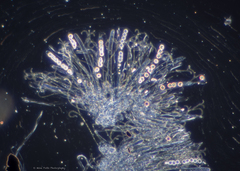 Pulvinula archeri
