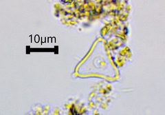 Desmidiaceae