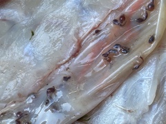 Ascaris lumbricoides